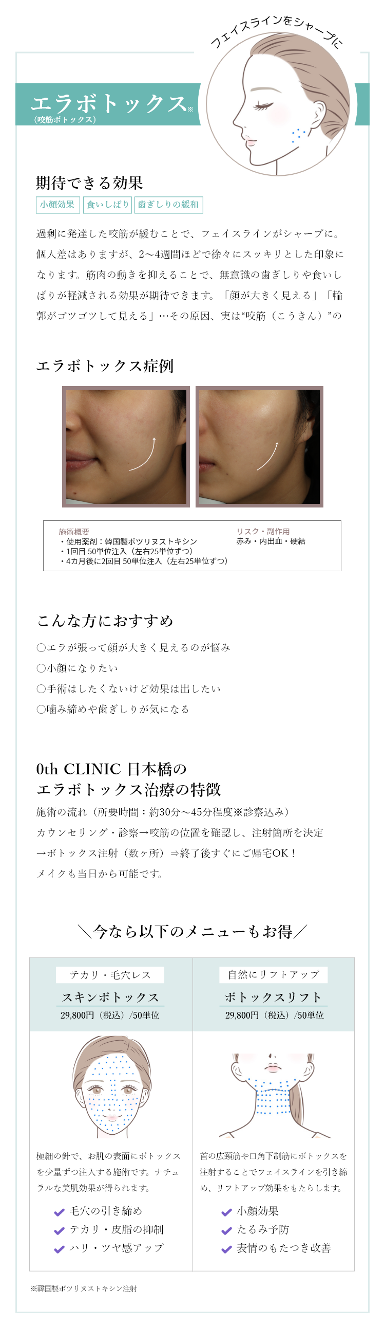 エラボトックス