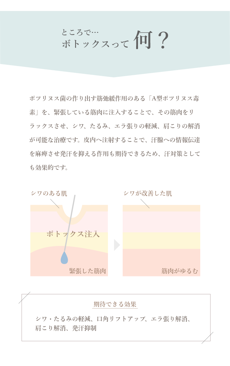 ボトックスとは