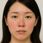 赤みに悩む女性