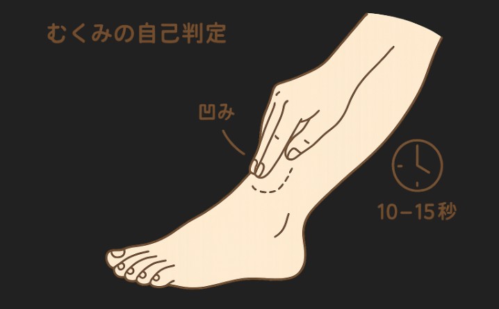 足のセルフチェックと「むくみ・しびれ」対策|“毎日3分”で潰瘍を防ぐ