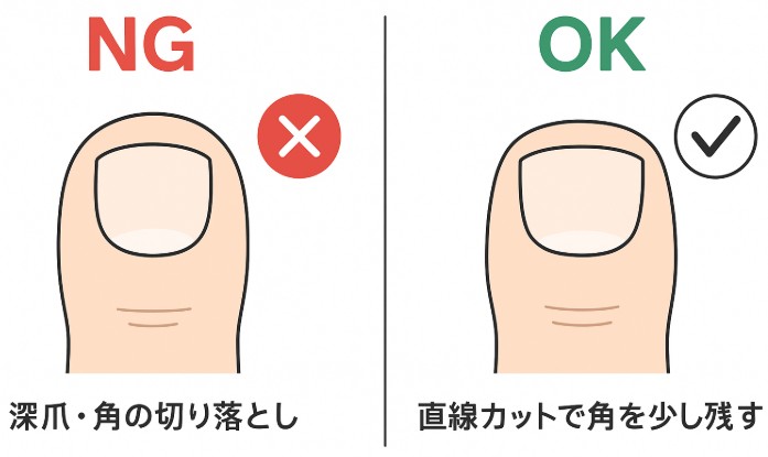 足のセルフチェックと「むくみ・しびれ」対策|“毎日3分”で潰瘍を防ぐ