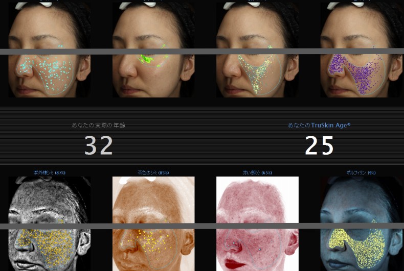 【最新肌診断】VISIA（ビジア）による肌解析