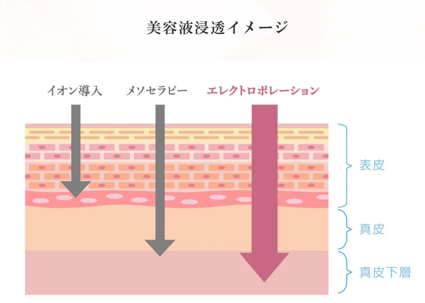 エレクトロポレーション｜VISIAつき