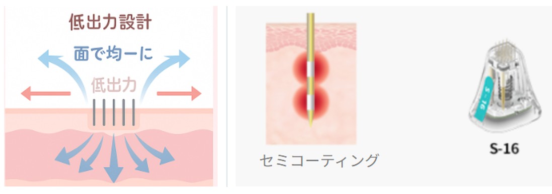 ポテンツァ（肝斑モード）｜摩擦・出力を抑えた低侵襲アプローチで“にじみ”を整える