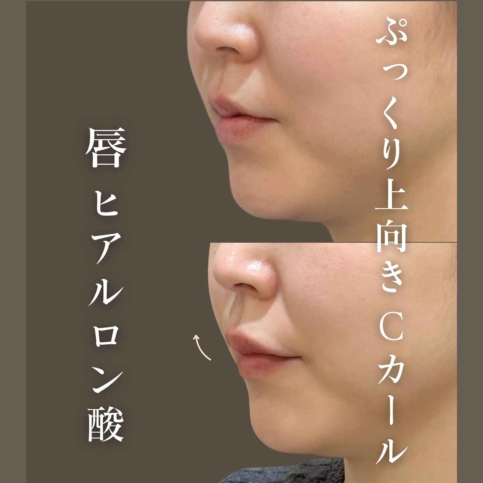 キャンペーン一覧