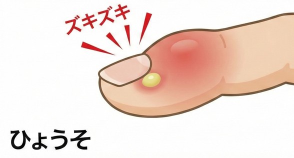 皮膚の感染症（蜂窩織炎・ひょうそ・爪周囲炎など）