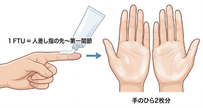 ヒルドイド（ヘパリン類似物質）の塗り方｜顔・ニキビ・市販との違い・FTU【医師監修】