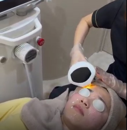 ルメッカ（Lumecca）総合ガイド｜効果・料金・ダウンタイム・適応