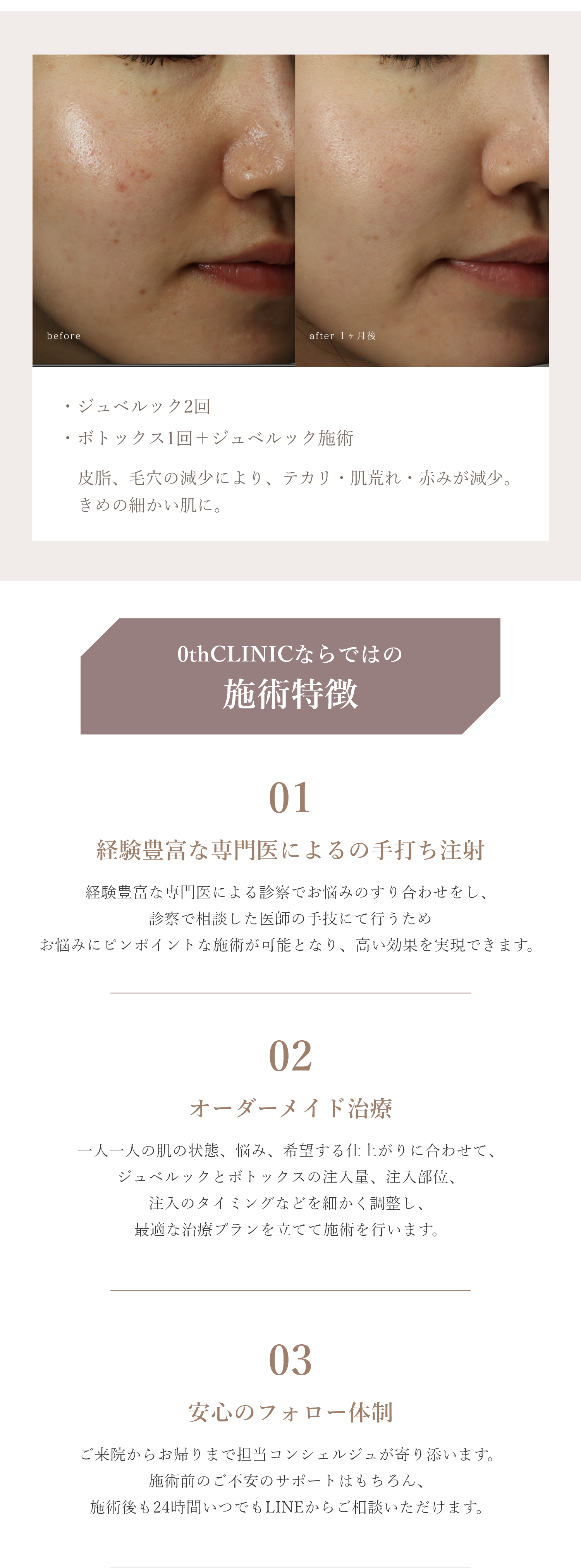 施術例、特徴