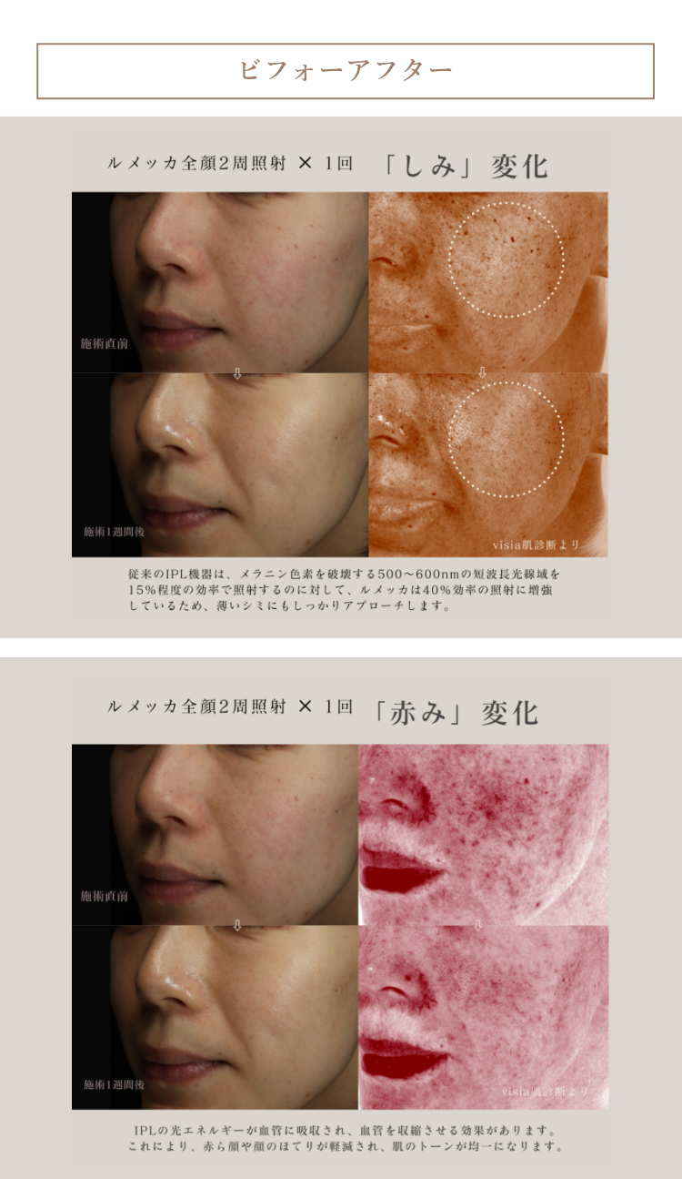 ビフォーアフター